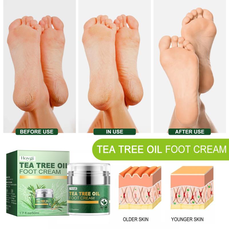 Tea Tree Foot Cream Repairing Cracked Heel Controling Calluses Removal Rough Dry Thick Skin Refresh Care Moisturization Cream one size
Tea Tree Foot Cream Repairing Cracked Heel Controling Calluses Removal Rough Dry Thick Skin Refresh Care Moisturization Cream one size