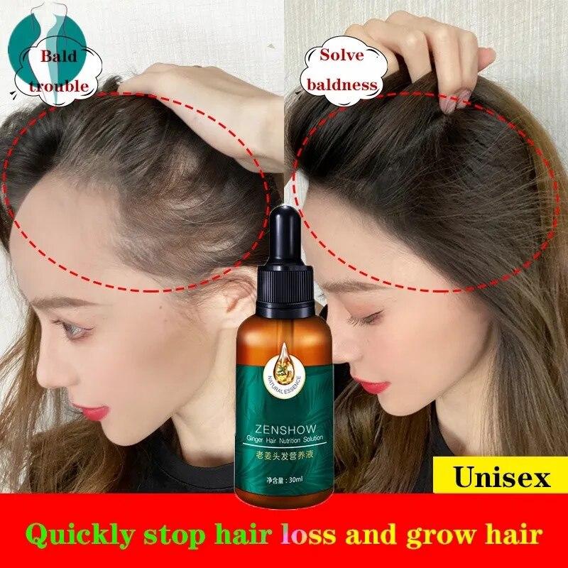 Эссенция для лечения роста волос, сыворотка для волос, имбирь, спрей против выпадения волос, эссенция
Эссенция для лечения роста волос, сыворотка для волос, имбирь, спрей против выпадения волос, эссенция