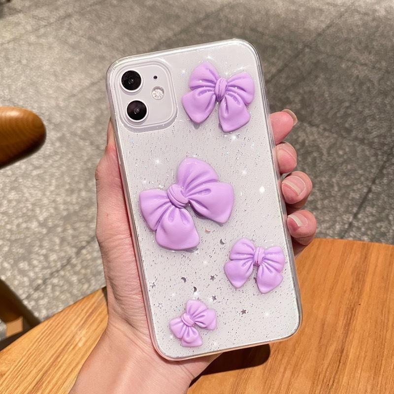 Apple 17Promax Case For 16Plus Bow Glitter 14 Transparent 15 Soft Case Female Internet Celebrity iPhone 17Promax
Apple 17Promax Case For 16Plus Bow Glitter 14 Transparent 15 Soft Case Female Internet Celebrity iPhone 17Promax