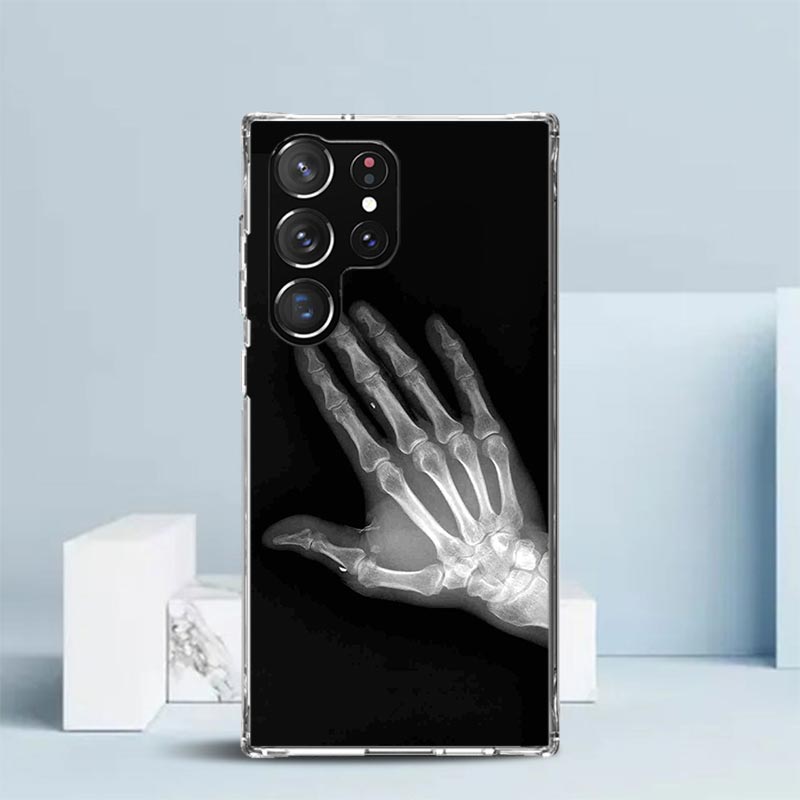 Autumu X Ray Hand Bones Soft Cover for Samsung Galaxy S25 Edge S26 S24 S23 Ultra Phone Case S22 S21 Plus S20 FE Print Pattern Sh Samsung S22
Autumu X Ray Hand Bones Soft Cover for Samsung Galaxy S25 Edge S26 S24 S23 Ultra Phone Case S22 S21 Plus S20 FE Print Pattern Sh Samsung S22