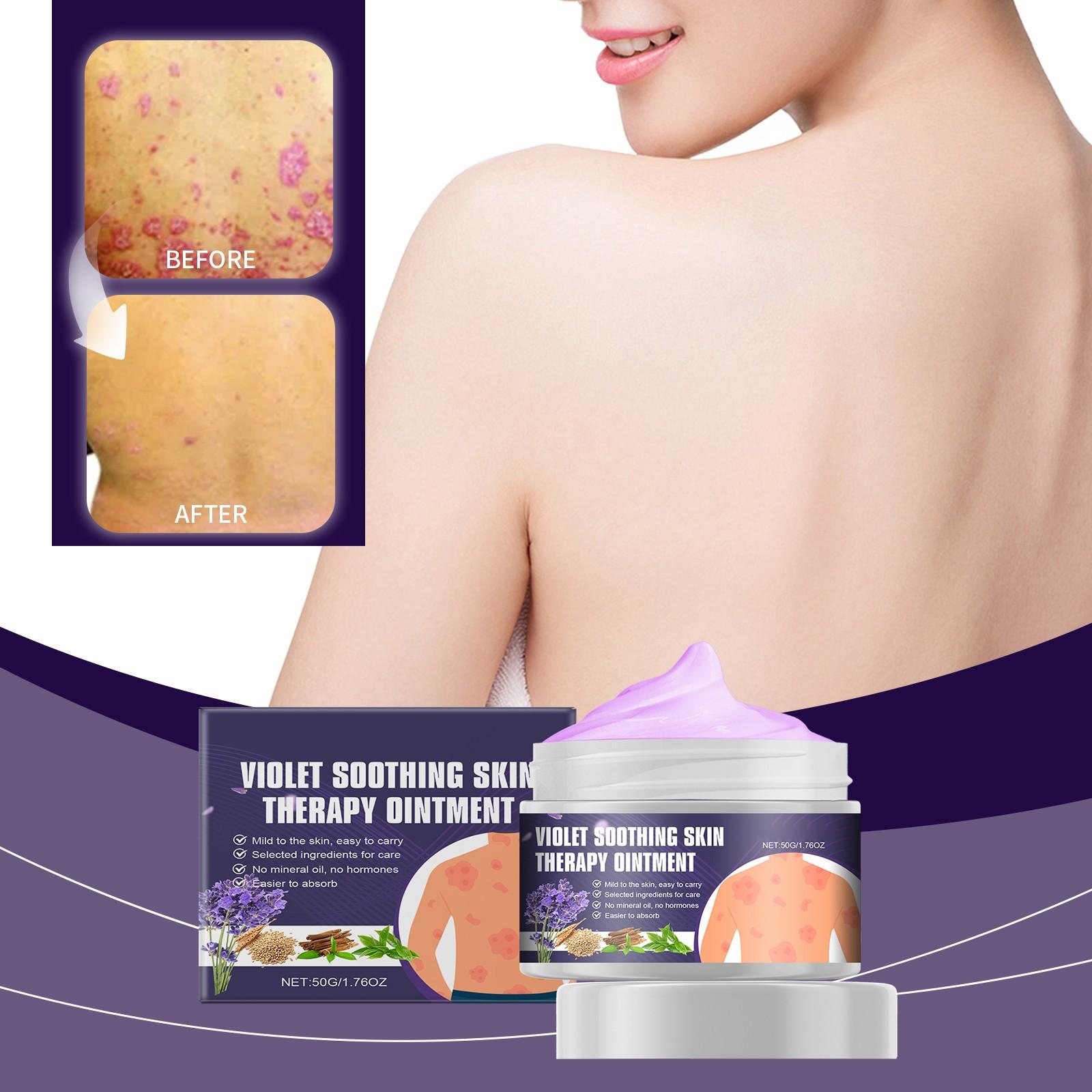 Violet Skin Eczema Soothing Cream Soothes Eczema Itching Pain Improves Rash Restores Skin Comfort Gentle Moisturizing
Violet Skin Eczema Soothing Cream Soothes Eczema Itching Pain Improves Rash Restores Skin Comfort Gentle Moisturizing