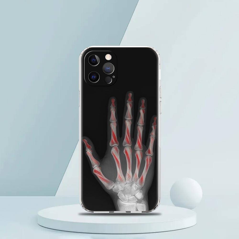 Transparent Phone Case Cover for iPhone 16,15,14,13,12,11,Pro,Max,8,7,Plus,16E,XS,Max Soft TPU Shell Autumu X Ray Hand Bones Bag iPhone 12 Pro
Transparent Phone Case Cover for iPhone 16,15,14,13,12,11,Pro,Max,8,7,Plus,16E,XS,Max Soft TPU Shell Autumu X Ray Hand Bones Bag iPhone 12 Pro