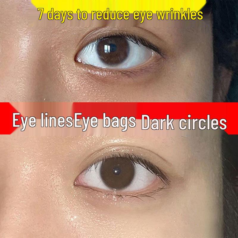 Anti-Wrinkle Eye Cream: Firming, Dark Circles & Fine Lines Reducer Caviar Anti-Wrinkle Eye Cream 100g
Anti-Wrinkle Eye Cream: Firming, Dark Circles & Fine Lines Reducer Caviar Anti-Wrinkle Eye Cream 100g