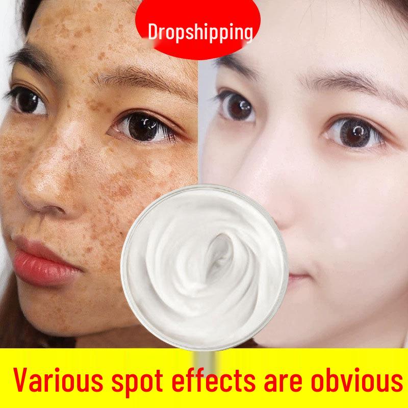 Freckle & Melasma Brightening Cream - Anti-Melanin, Age Spot Corrector for Salon Use Finished Luxurious
Freckle & Melasma Brightening Cream - Anti-Melanin, Age Spot Corrector for Salon Use Finished Luxurious