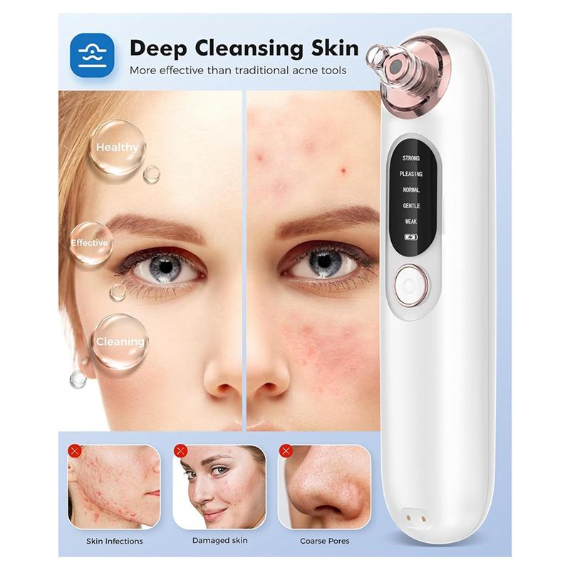 Stainless Steel For Sensitive Skin Blackhead Remover, Face Pore Cleanser With 4 Removable Heads Included Kit білий
Stainless Steel For Sensitive Skin Blackhead Remover, Face Pore Cleanser With 4 Removable Heads Included Kit білий