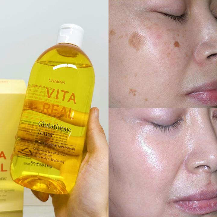 Глутатион Тоник для удаления пигментных пятен и мелазмы
Глутатион Тоник для удаления пигментных пятен и мелазмы