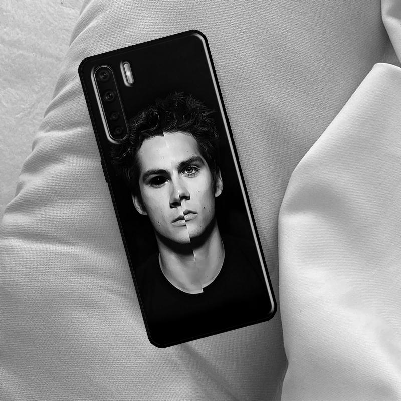 Teen Wolf Case For Oppo A17 A94 A74 A54 A60 A40 A80 A16 A76 A96 A98 A58 A78 A18 A38 A57 A15 A5 A6 Pro OPPO A76
Teen Wolf Case For Oppo A17 A94 A74 A54 A60 A40 A80 A16 A76 A96 A98 A58 A78 A18 A38 A57 A15 A5 A6 Pro OPPO A76