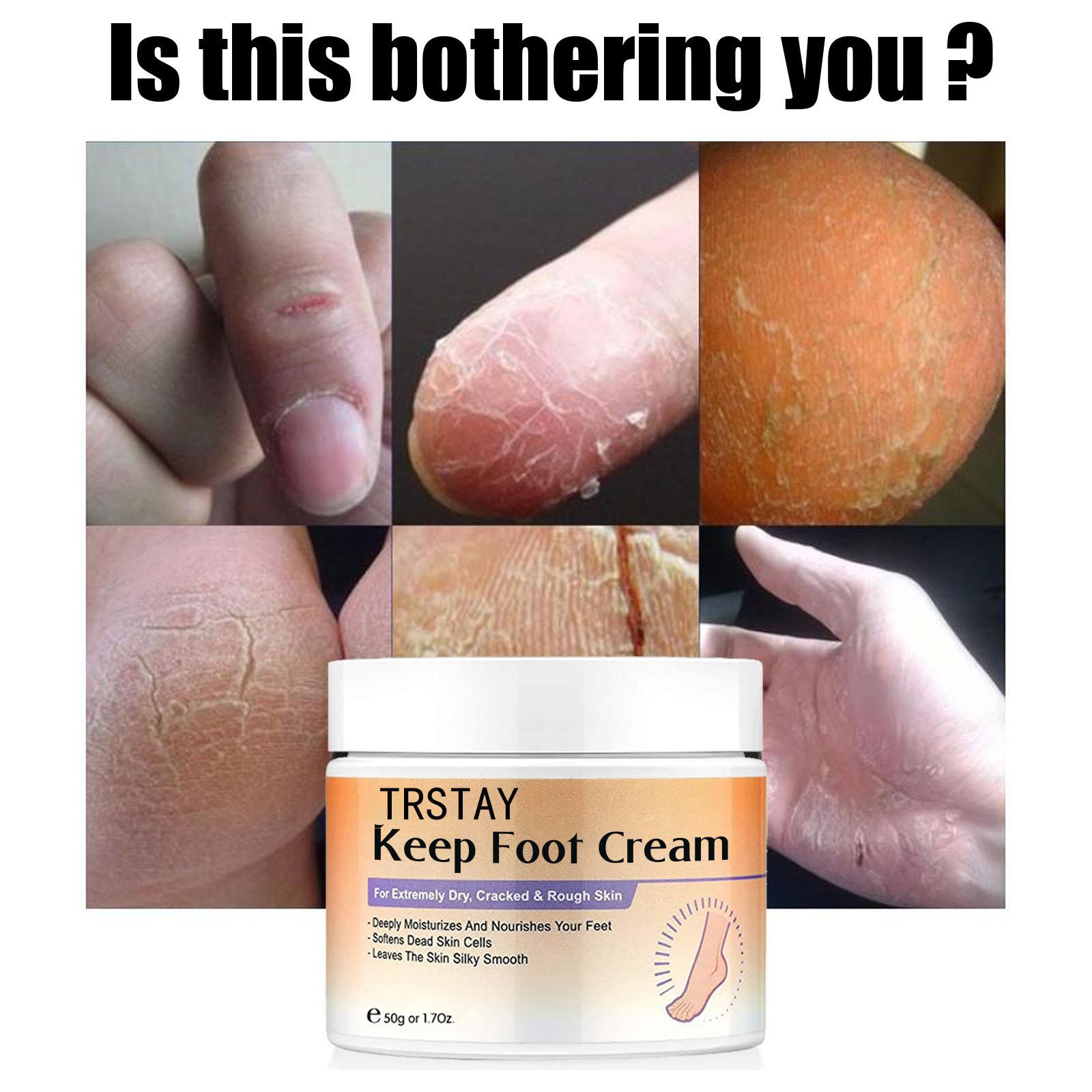 Массаж ног Отшелушивающий крем Крем для ног Крем для ног Уход за ногами Увлажняющий Увлажняющий
Массаж ног Отшелушивающий крем Крем для ног Крем для ног Уход за ногами Увлажняющий Увлажняющий