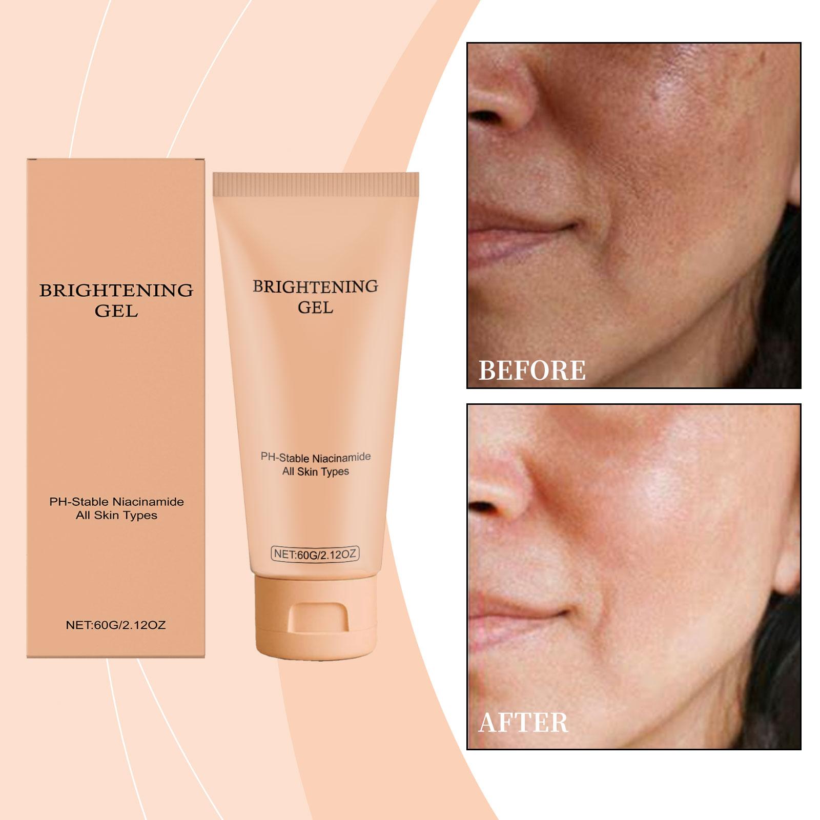 Гель для ухода, придающий сияние коже, очищает и улучшает уход за кожей лица, глубоко питает, смягчает, мягко осветляет и ухаживает One Size жёлтый
Гель для ухода, придающий сияние коже, очищает и улучшает уход за кожей лица, глубоко питает, смягчает, мягко осветляет и ухаживает One Size жёлтый