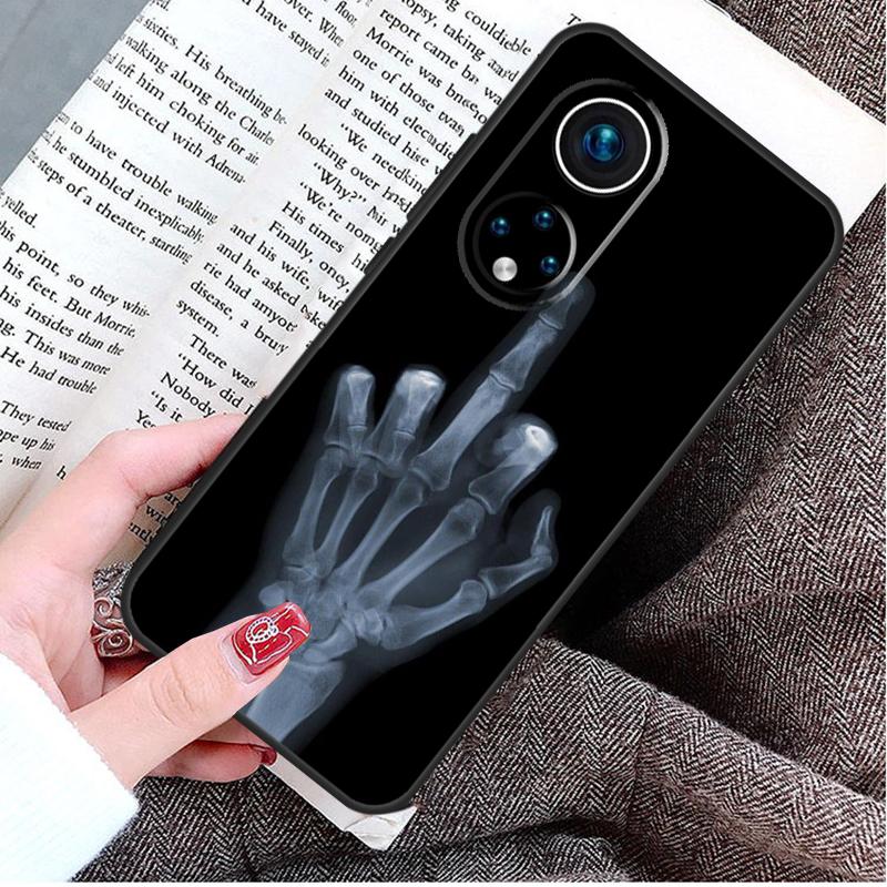 Middle Finger Case For Honor Magic 8 5 6 7 Lite Honor 200 400 Pro 50 70 90 X9d X9b X9c X9a X8c X8b Win RT Honor Magic7 Lite
Middle Finger Case For Honor Magic 8 5 6 7 Lite Honor 200 400 Pro 50 70 90 X9d X9b X9c X9a X8c X8b Win RT Honor Magic7 Lite