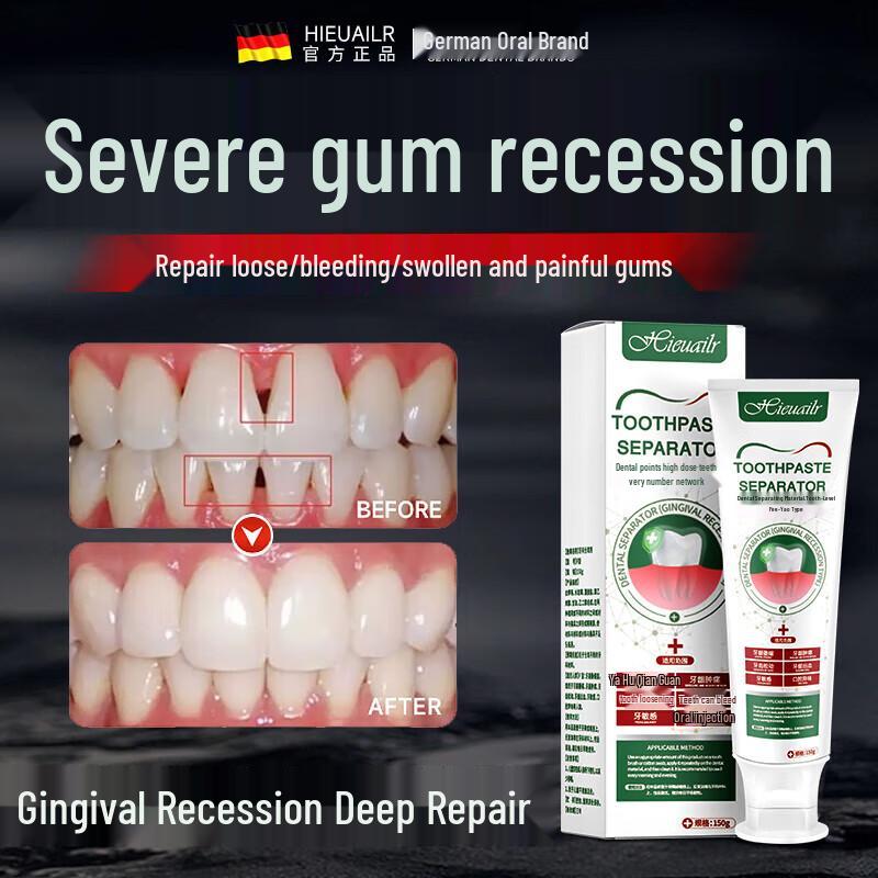 HIEUAILR Oral Care Collection
HIEUAILR Oral Care Collection