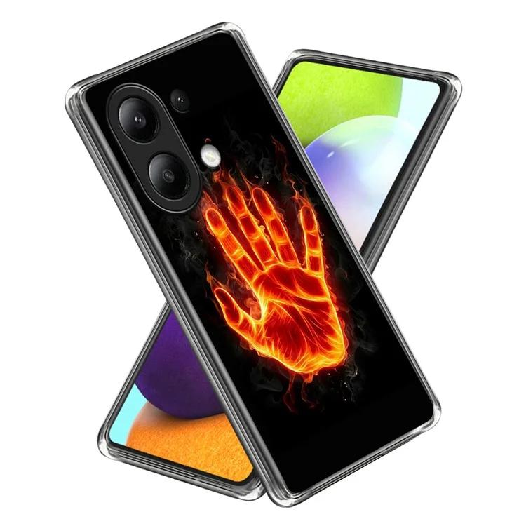 For Xiaomi Redmi Note 13 4G Slim Case Anti-Scratch Pattern Printing TPU Phone Cover
For Xiaomi Redmi Note 13 4G Slim Case Anti-Scratch Pattern Printing TPU Phone Cover