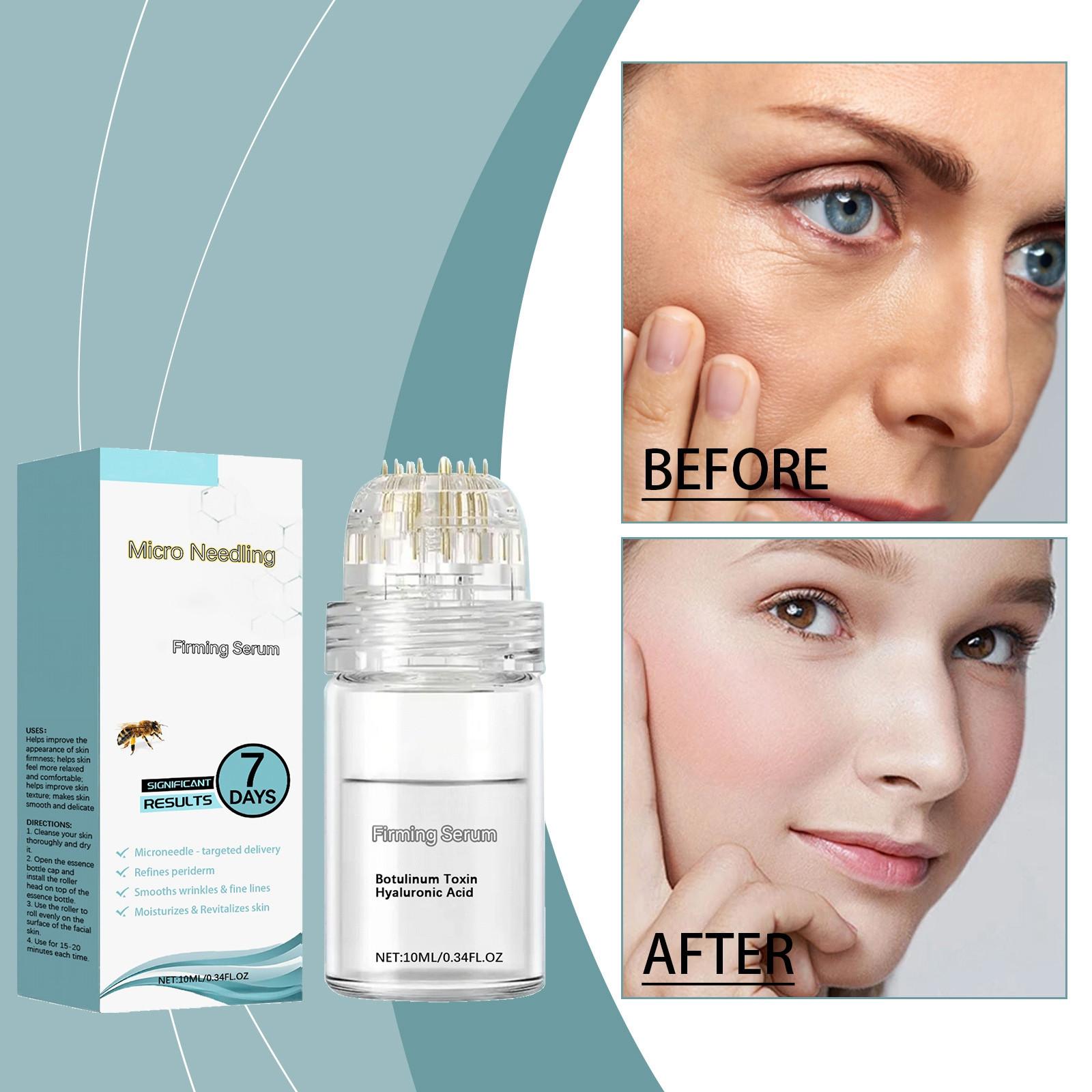 Micro Needle Firming Liquid Enhances Skin Firmness, Improves Texture, And Daily Skin Care Lotion,10ML One Size білий
Micro Needle Firming Liquid Enhances Skin Firmness, Improves Texture, And Daily Skin Care Lotion,10ML One Size білий