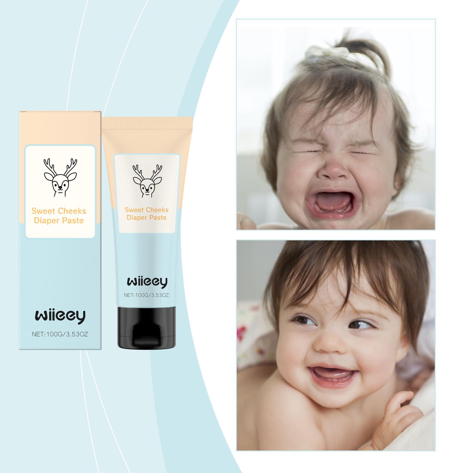 Wiieey Butt Paste Gentle Protection Children s Moisturizing and Nourishing Skin Frequent Diaper Changing Daily Butt Paste
Wiieey Butt Paste Gentle Protection Children s Moisturizing and Nourishing Skin Frequent Diaper Changing Daily Butt Paste