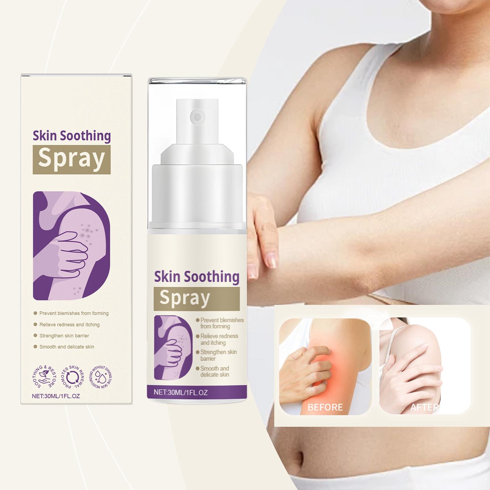 Skin Soothing Spray, Anti-acne, Relieves Redness And Itching, Soothing Water, Gently Soothes The Skin Without Irritation,30ML One Size белый
Skin Soothing Spray, Anti-acne, Relieves Redness And Itching, Soothing Water, Gently Soothes The Skin Without Irritation,30ML One Size белый
