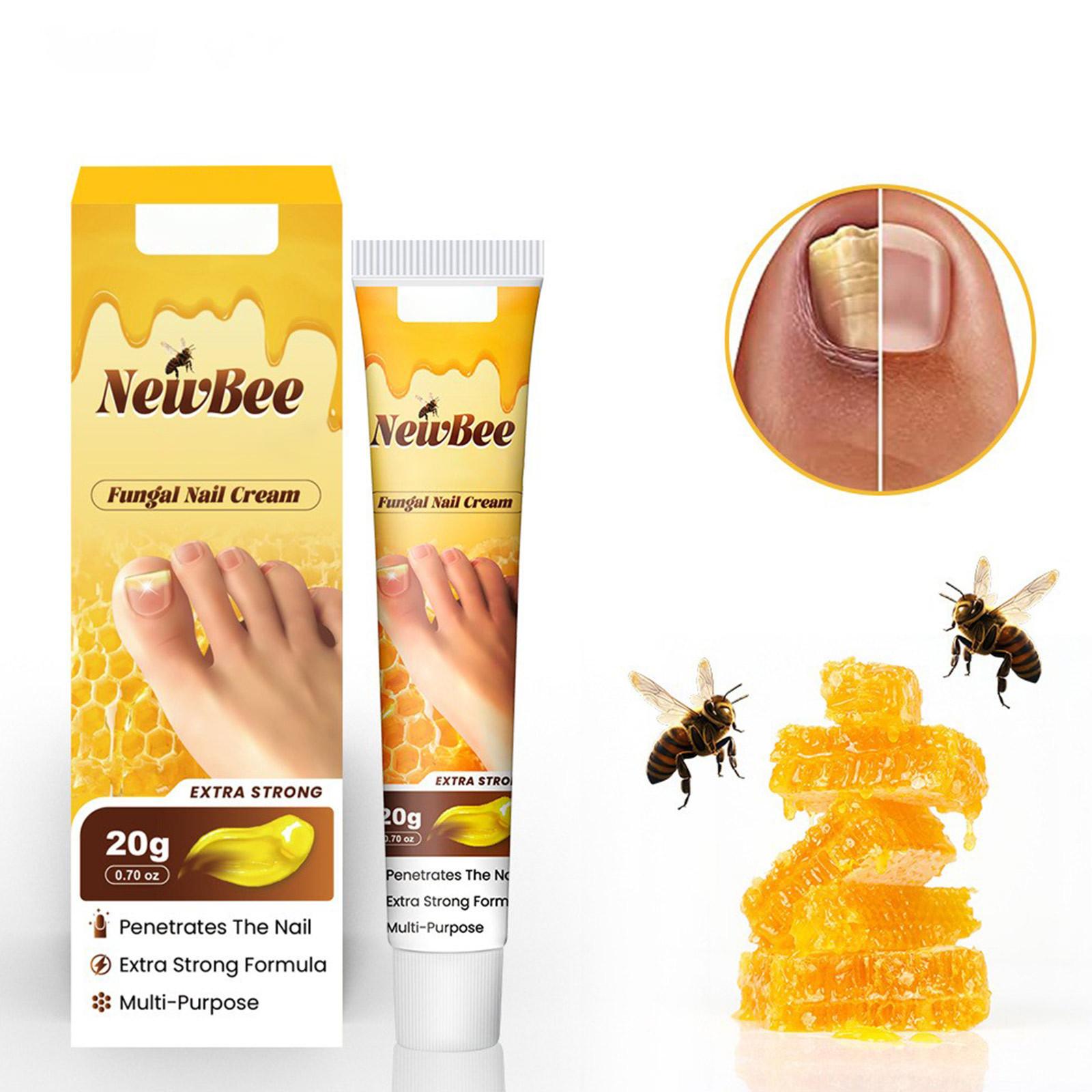 Крем для лечения онихомикоза Bee Onychomycosis Care Увлажняющий крем для ухода за кожей One Size
Крем для лечения онихомикоза Bee Onychomycosis Care Увлажняющий крем для ухода за кожей One Size