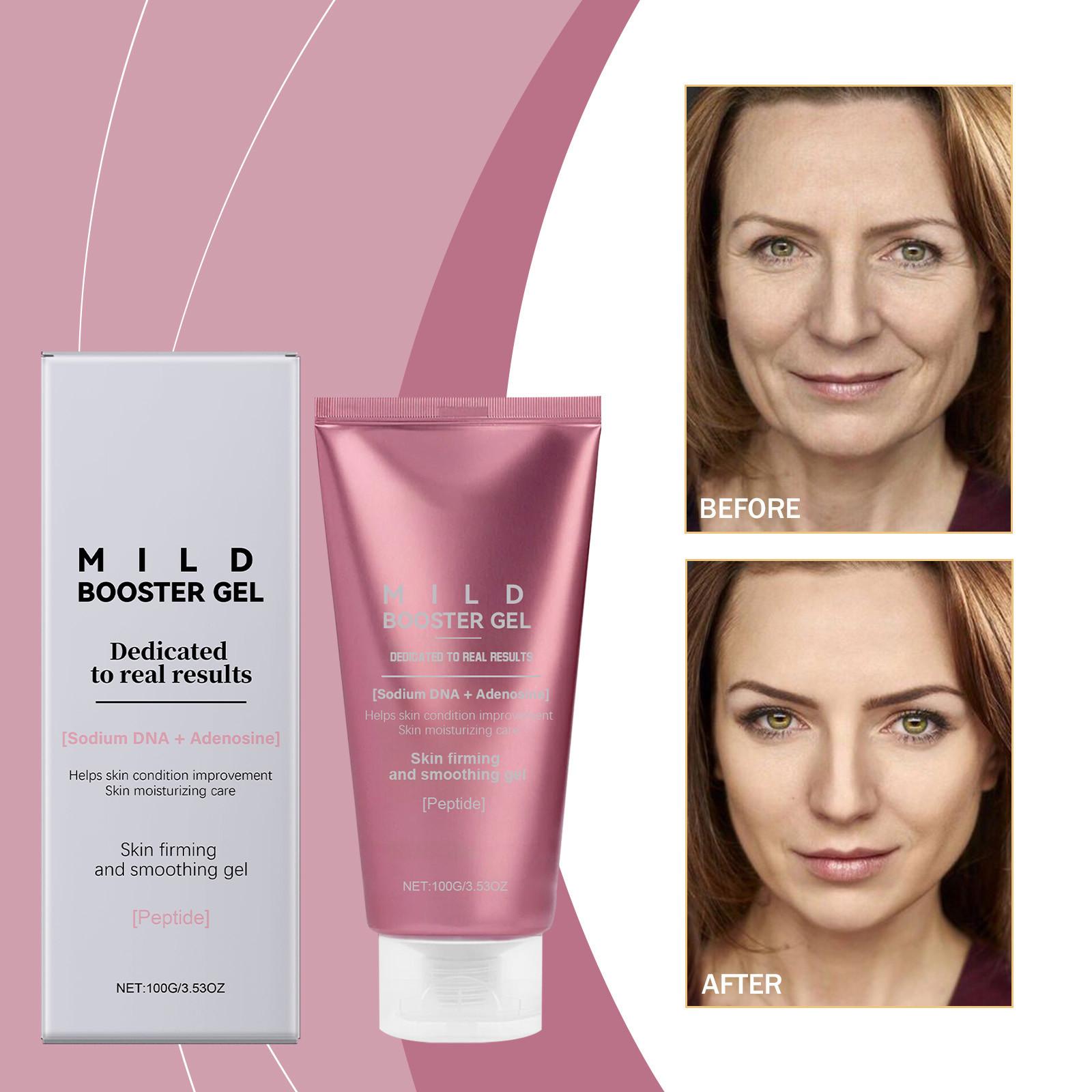 Mild Booster Gel,Booster Gel,Skin Gel,Lock In Moisture And Keep The Skin Hydrated.Lifting, Moisturizing, Not Greasy Or Heavy,100g, One Size розовый
Mild Booster Gel,Booster Gel,Skin Gel,Lock In Moisture And Keep The Skin Hydrated.Lifting, Moisturizing, Not Greasy Or Heavy,100g, One Size розовый