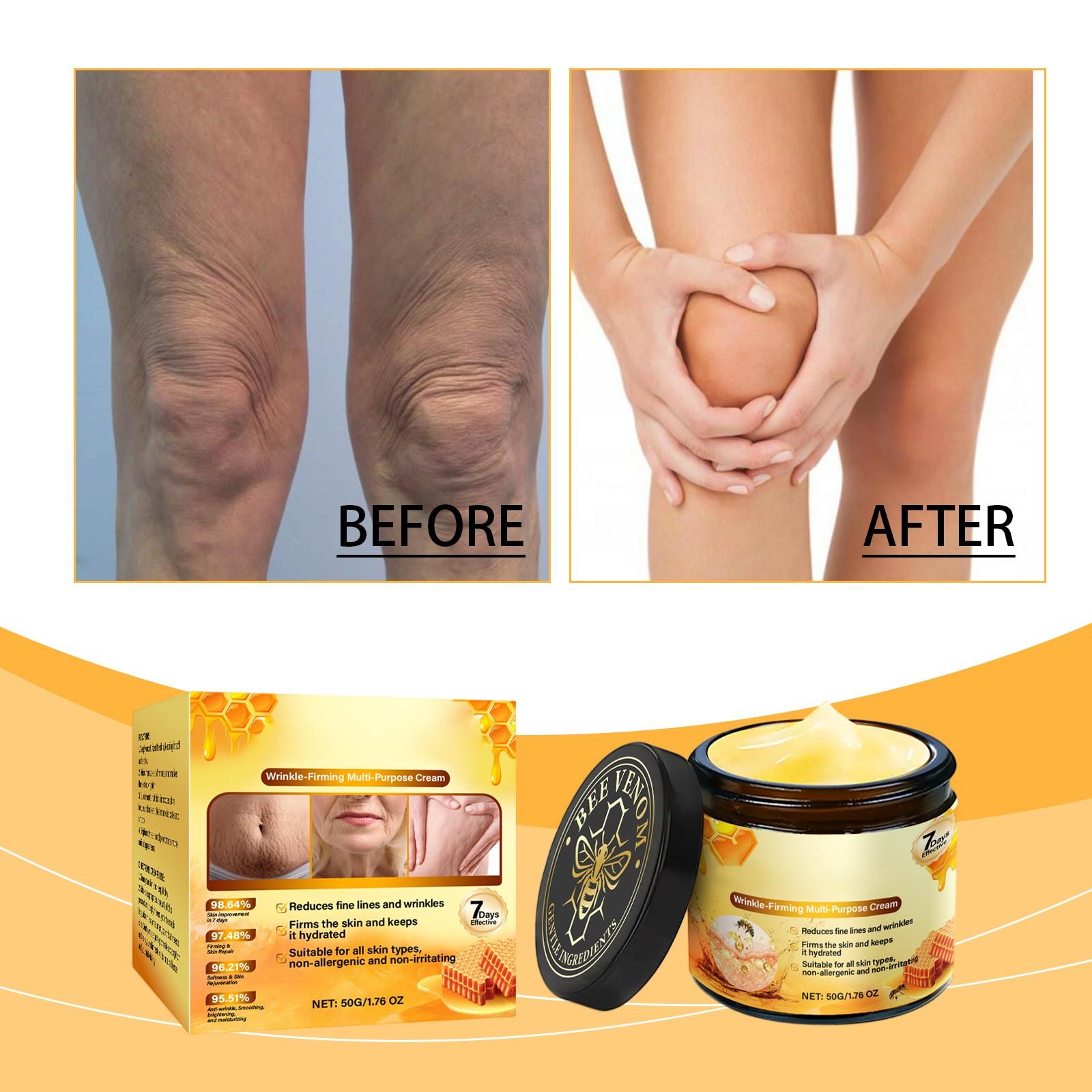 Bee Anti-wrinkle Firming Cream Deeply Moisturizes And Tightens The Skin To The Skin Hydrating And Moisturizing Skin Care Cream One Size
Bee Anti-wrinkle Firming Cream Deeply Moisturizes And Tightens The Skin To The Skin Hydrating And Moisturizing Skin Care Cream One Size
