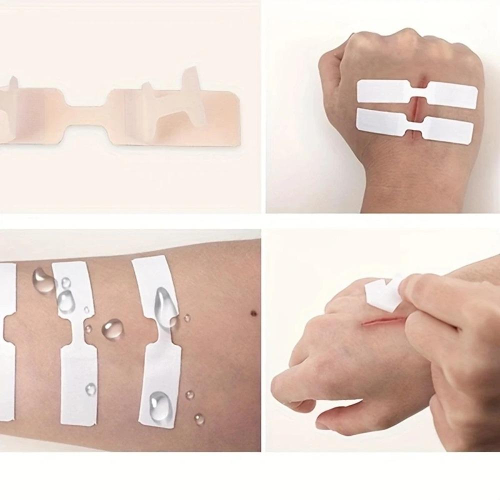 50Pcs Disposable Aid Wound Suture Patch Zipper Tie Wound Band Aid New Wound Adhesive Tape Outdoor
50Pcs Disposable Aid Wound Suture Patch Zipper Tie Wound Band Aid New Wound Adhesive Tape Outdoor