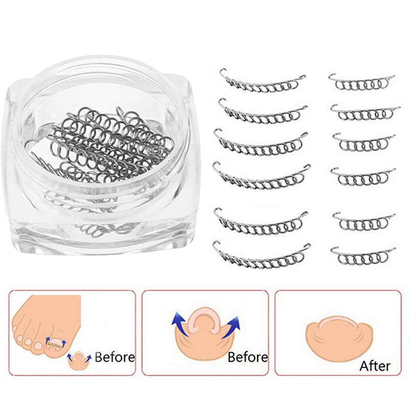 12 Pcs/box Ingrown Toe Nail Correction Wire Fixer Pedicure Paronychia Recover Toenails Corrector Foot Care Tool
12 Pcs/box Ingrown Toe Nail Correction Wire Fixer Pedicure Paronychia Recover Toenails Corrector Foot Care Tool