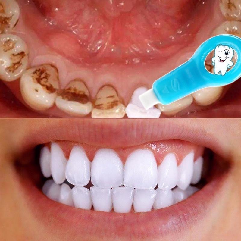 Устные Уход отбеливание Зубы Нано очищая зуб протрите
Устные Уход отбеливание Зубы Нано очищая зуб протрите