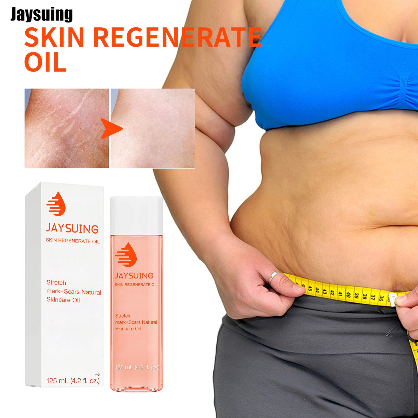 Масло Jaysuing Scar Repair Oil разбавляет шрамы, линии беременности, коррекция фигуры, живот, увлажняющий массаж, укрепляющий и разглаживающий кожу 1PC
Масло Jaysuing Scar Repair Oil разбавляет шрамы, линии беременности, коррекция фигуры, живот, увлажняющий массаж, укрепляющий и разглаживающий кожу 1PC