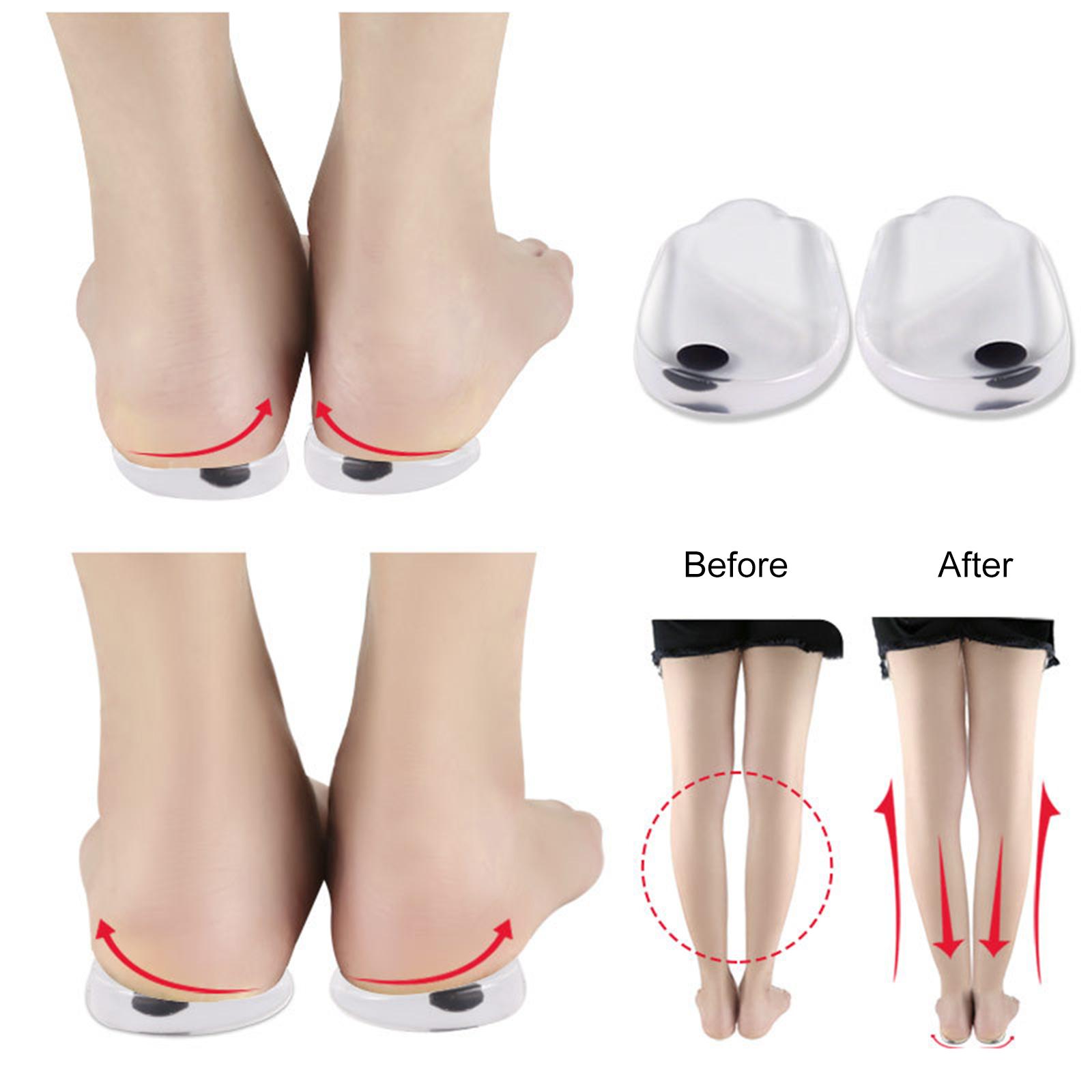 Orthopedic Insoles, 1 Pair Soft Silicone Gel Shoe Inserts for Knee Pain Relief and Foot Alignment, with Magnetic Pads
Orthopedic Insoles, 1 Pair Soft Silicone Gel Shoe Inserts for Knee Pain Relief and Foot Alignment, with Magnetic Pads