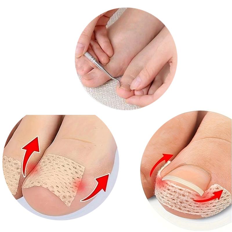Toe Nail Correction Patch Nail Recover Toe Care Tool Nail Tool Correction Pedicure Tool Set
Toe Nail Correction Patch Nail Recover Toe Care Tool Nail Tool Correction Pedicure Tool Set