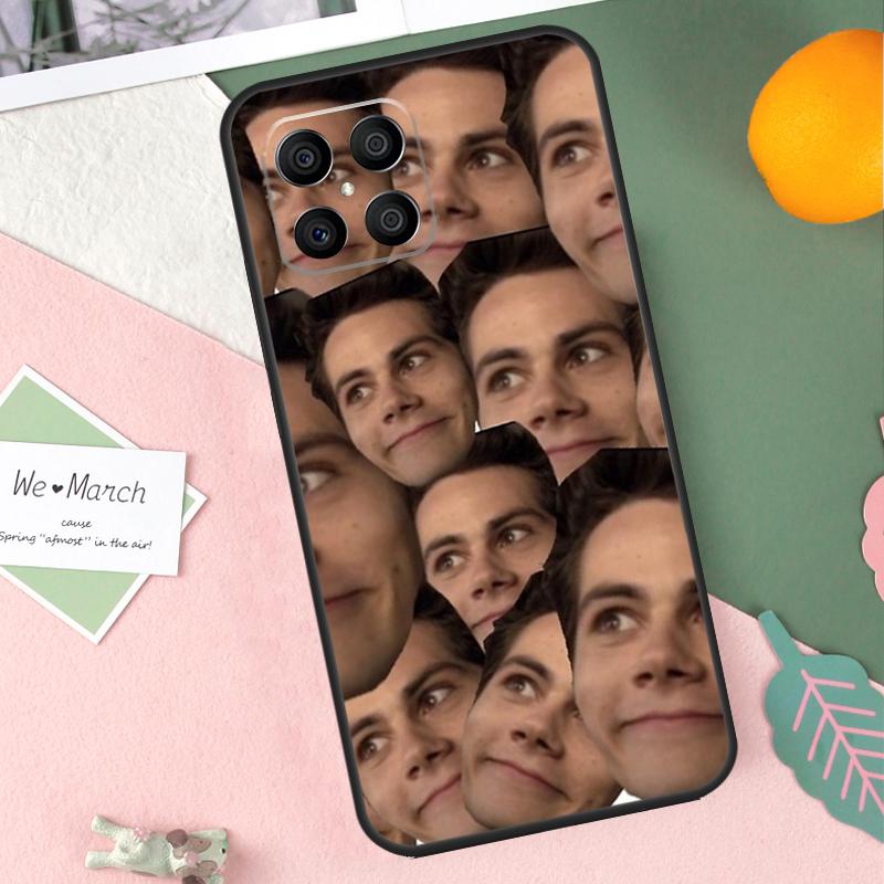 Dylan O Brien Teen Wolf Case For Honor 200 Lite 50 70 90 X9b X9a X8b X8a X8 X9 X9c Honor Magic 7 Pro 5 6 Lite Cover Honor Magic5 Lite
Dylan O Brien Teen Wolf Case For Honor 200 Lite 50 70 90 X9b X9a X8b X8a X8 X9 X9c Honor Magic 7 Pro 5 6 Lite Cover Honor Magic5 Lite