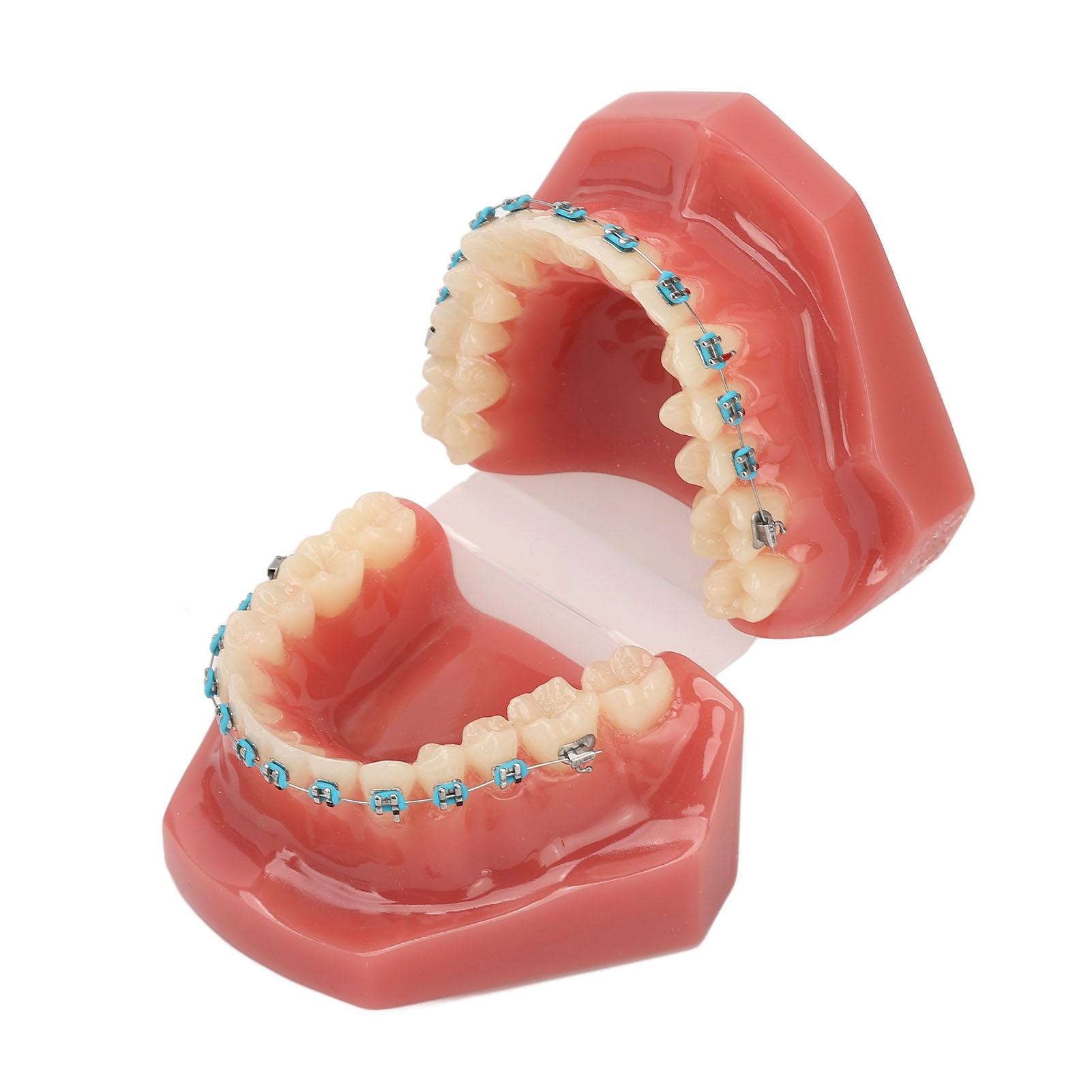 Dental Orthodontic Model 28pcs Teeth Resin Dental Teaching Teeth Model with Metal Braces
Dental Orthodontic Model 28pcs Teeth Resin Dental Teaching Teeth Model with Metal Braces