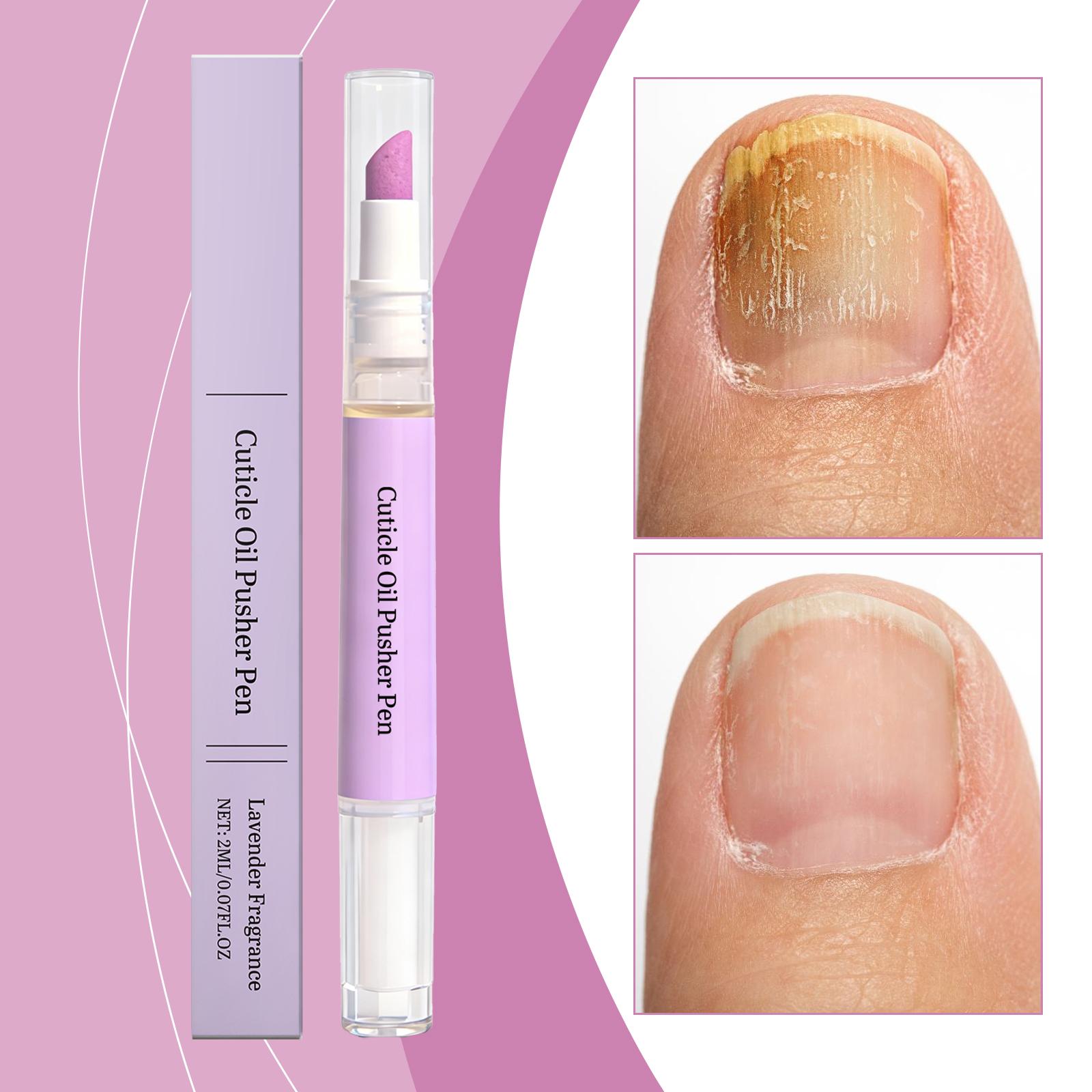 Nail Cuticle Care Oil Pen For Nourishing And Moisturizing The Nail Surface Daily Care Portable Nail Oil Pen For Application 2ml One Size білий
Nail Cuticle Care Oil Pen For Nourishing And Moisturizing The Nail Surface Daily Care Portable Nail Oil Pen For Application 2ml One Size білий