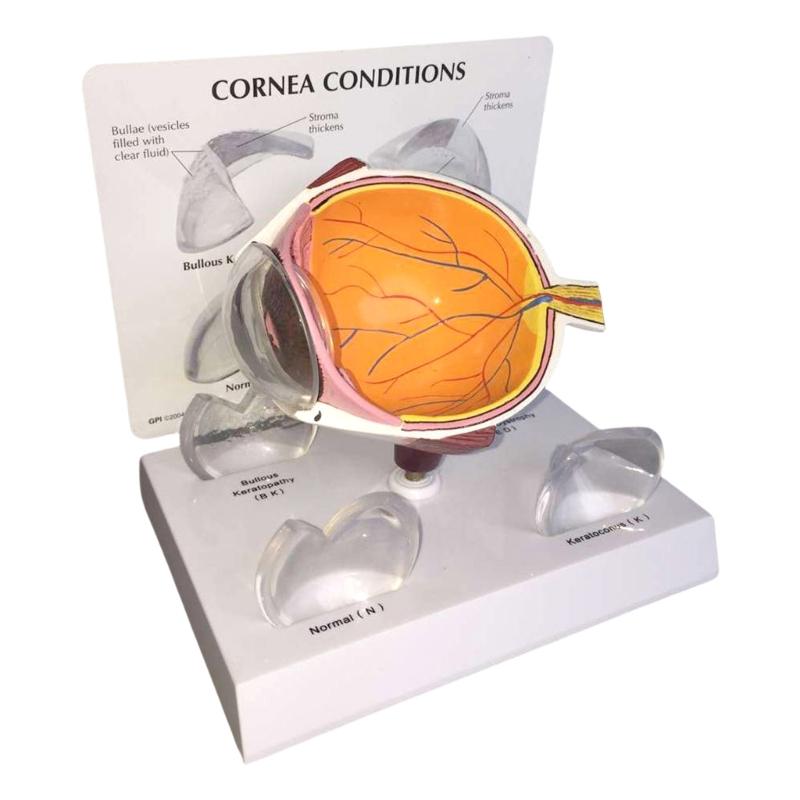 Патологическая модель анатомии глазного яблока Анатомическая модель глаза человека Учебное пособие для клинической практики Образовательное использование 1
Патологическая модель анатомии глазного яблока Анатомическая модель глаза человека Учебное пособие для клинической практики Образовательное использование 1