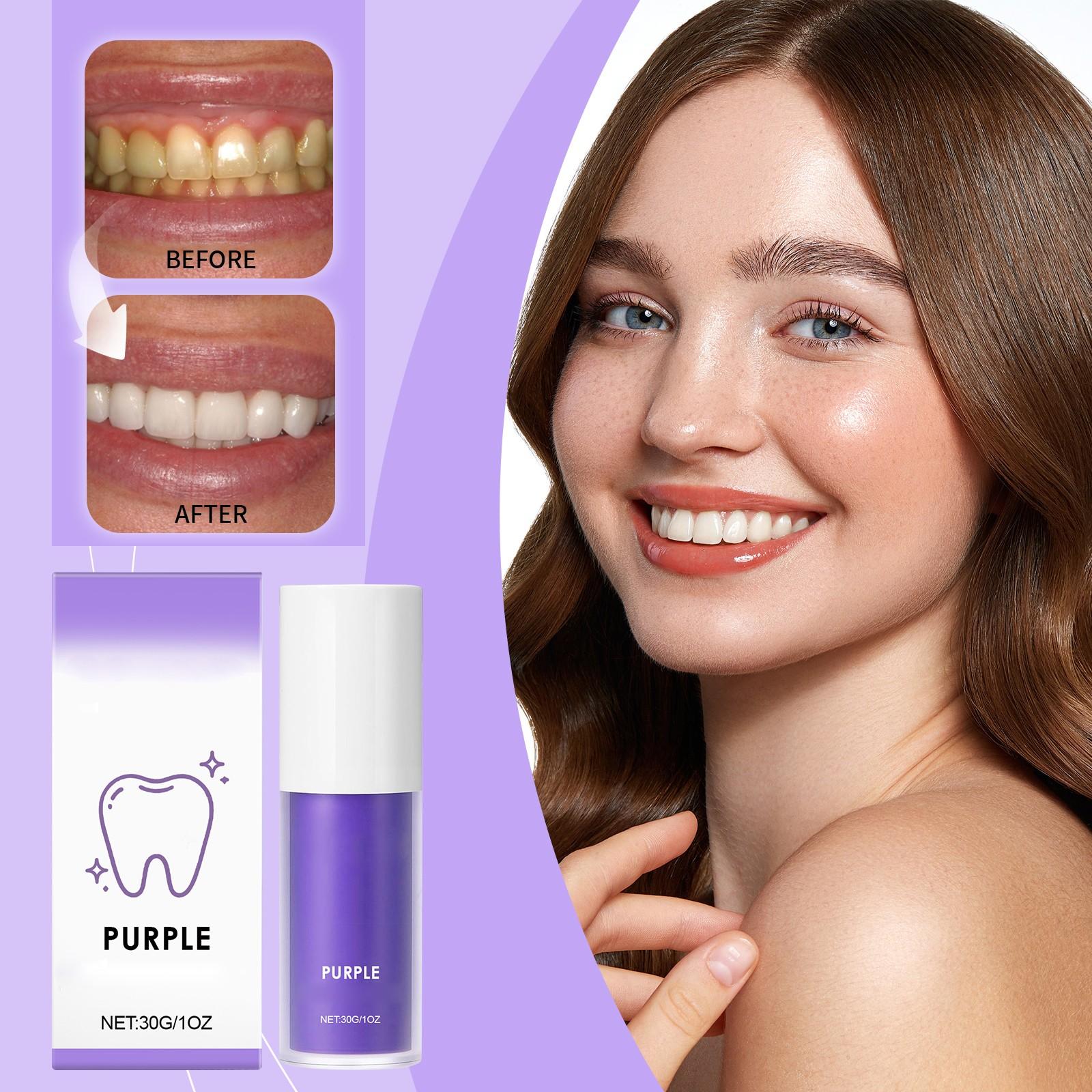 Purple Whitening Toothpaste Is Safe For Protecting Gums, Removing Stains And Tartar, Refreshing Breath, Preventing Tooth Decay
Purple Whitening Toothpaste Is Safe For Protecting Gums, Removing Stains And Tartar, Refreshing Breath, Preventing Tooth Decay