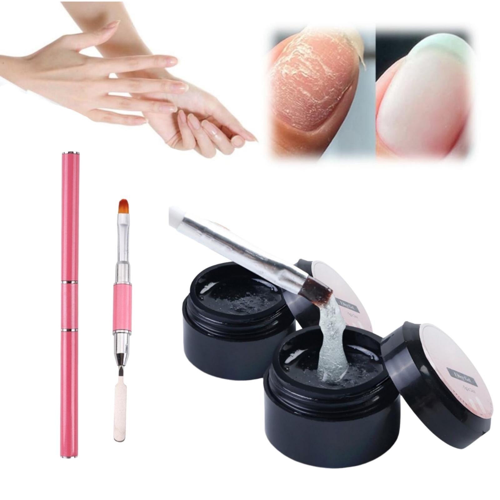 Набор для наращивания ногтей с гелем для потрескавшихся ногтей One Size
Набор для наращивания ногтей с гелем для потрескавшихся ногтей One Size