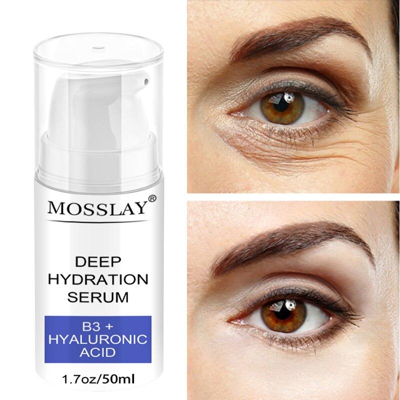 Осветление и удаление темных кругов, Удаление мешков под глазами, Сыворотка против морщин, Осветление и увлажнение, Уход за глазами, Крем для глаз с витамином С
Осветление и удаление темных кругов, Удаление мешков под глазами, Сыворотка против морщин, Осветление и увлажнение, Уход за глазами, Крем для глаз с витамином С