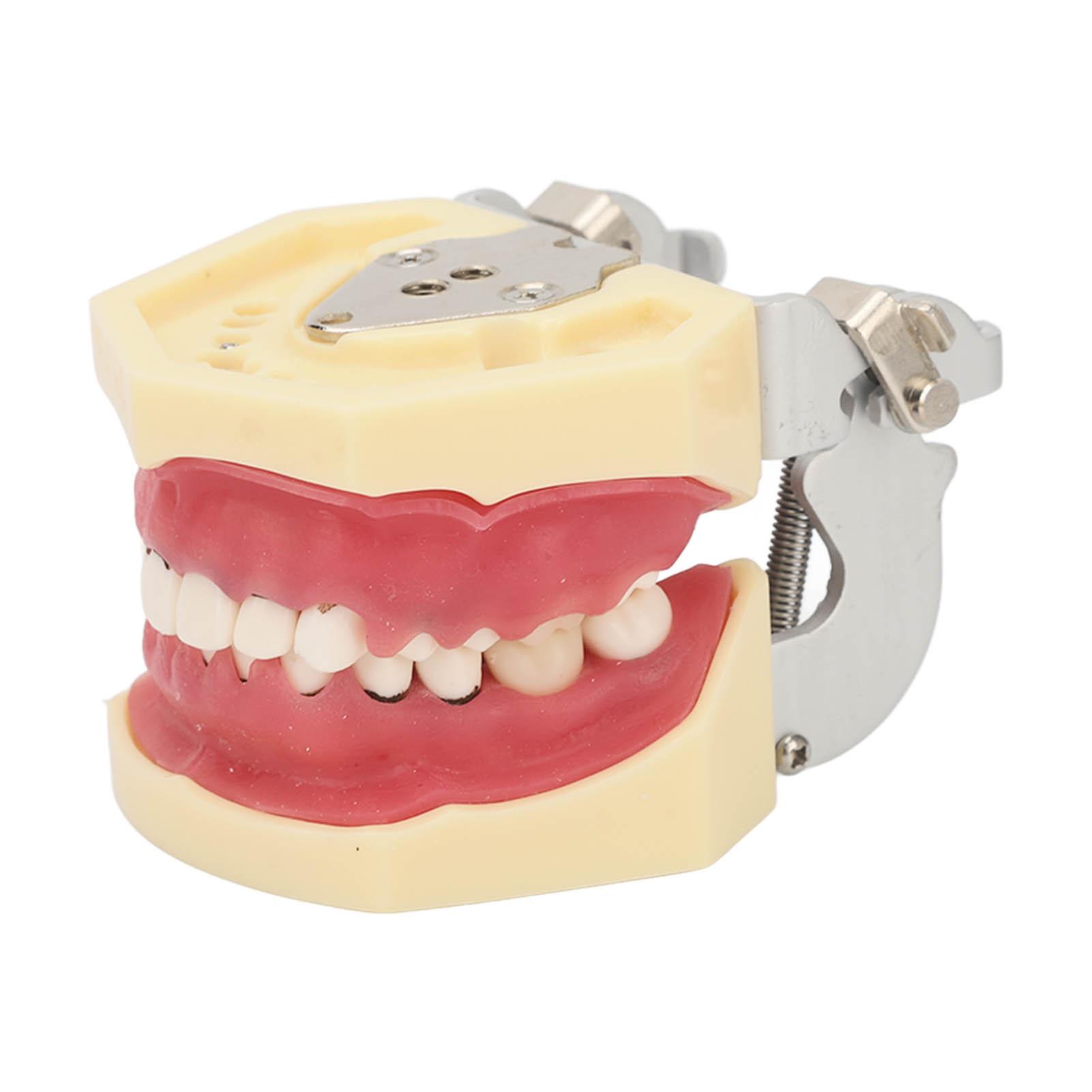 Periodontal Disease Teeth Resin Model Dental Demonstration Teeth Model for Teaching Studying
Periodontal Disease Teeth Resin Model Dental Demonstration Teeth Model for Teaching Studying