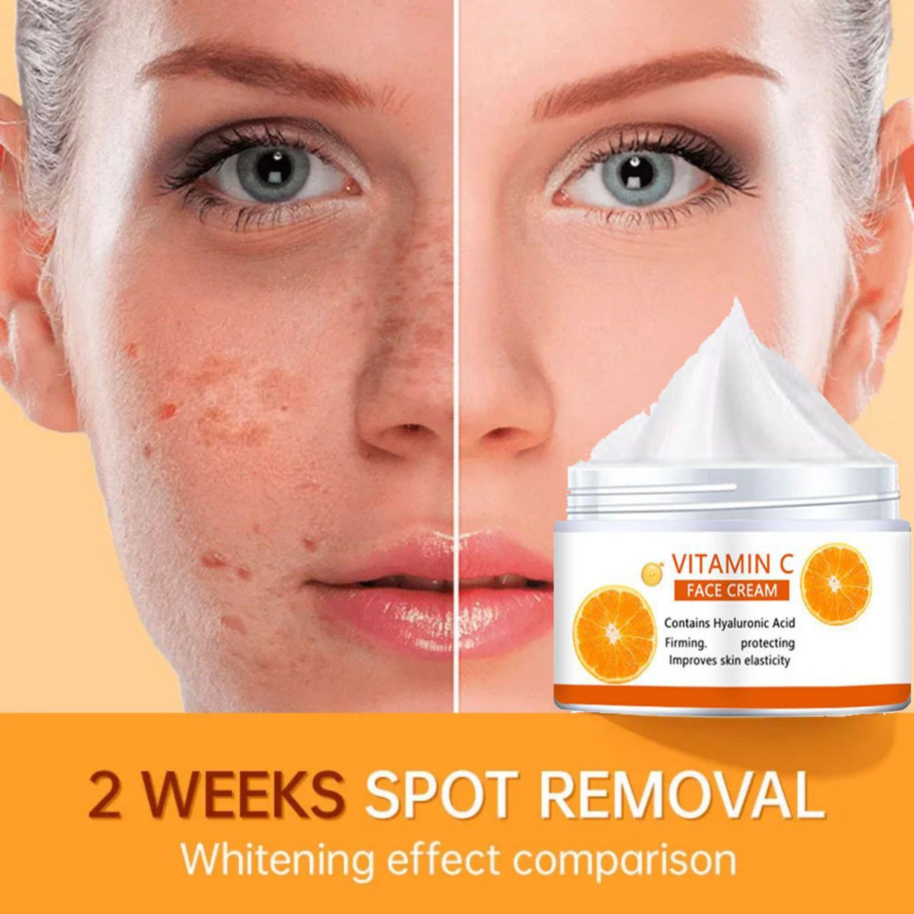Vitamin C Whitening, Moisturizing, Soothing and Repairing Cream Anti aging, Moisturizing, Whitening and Moisturizing face cream
Vitamin C Whitening, Moisturizing, Soothing and Repairing Cream Anti aging, Moisturizing, Whitening and Moisturizing face cream