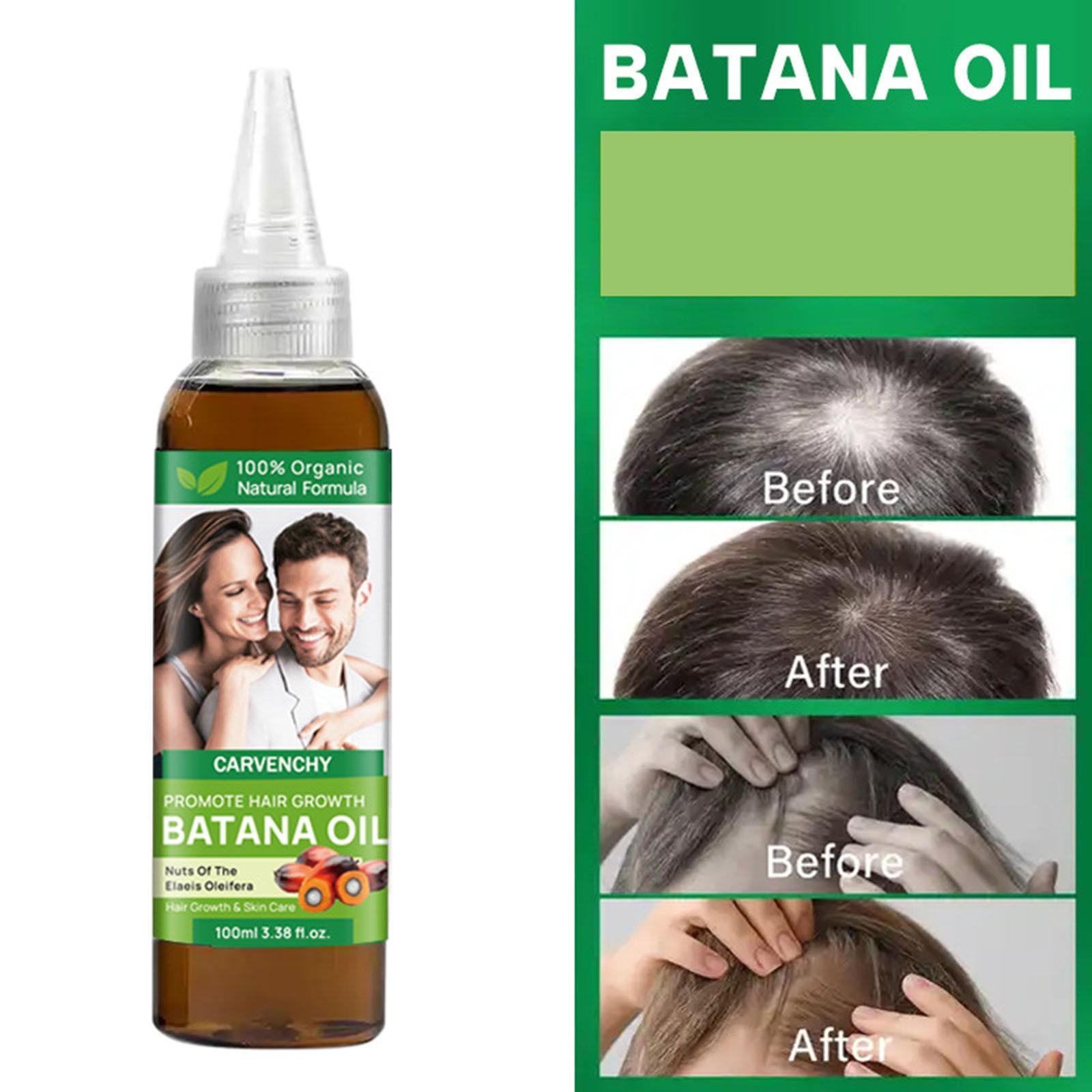 Масло для волос Batana Natural Pures Натуральное масло для волос Унисекс Масло для ухода за вьющимися волосами
Масло для волос Batana Natural Pures Натуральное масло для волос Унисекс Масло для ухода за вьющимися волосами