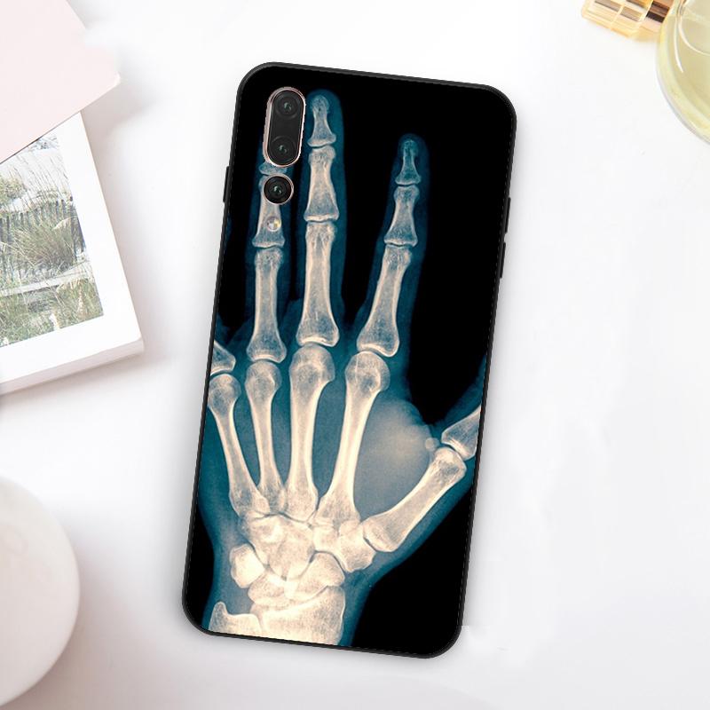 X-Ray Human Anatomy For Huawei Nova 12i 12s 11i 7i 8i Y73 Y70 Y90 Y60 Y72 Y61 Y91 9 10 SE P30 Pro P40 Lite Case Huawei Nova 11i
X-Ray Human Anatomy For Huawei Nova 12i 12s 11i 7i 8i Y73 Y70 Y90 Y60 Y72 Y61 Y91 9 10 SE P30 Pro P40 Lite Case Huawei Nova 11i