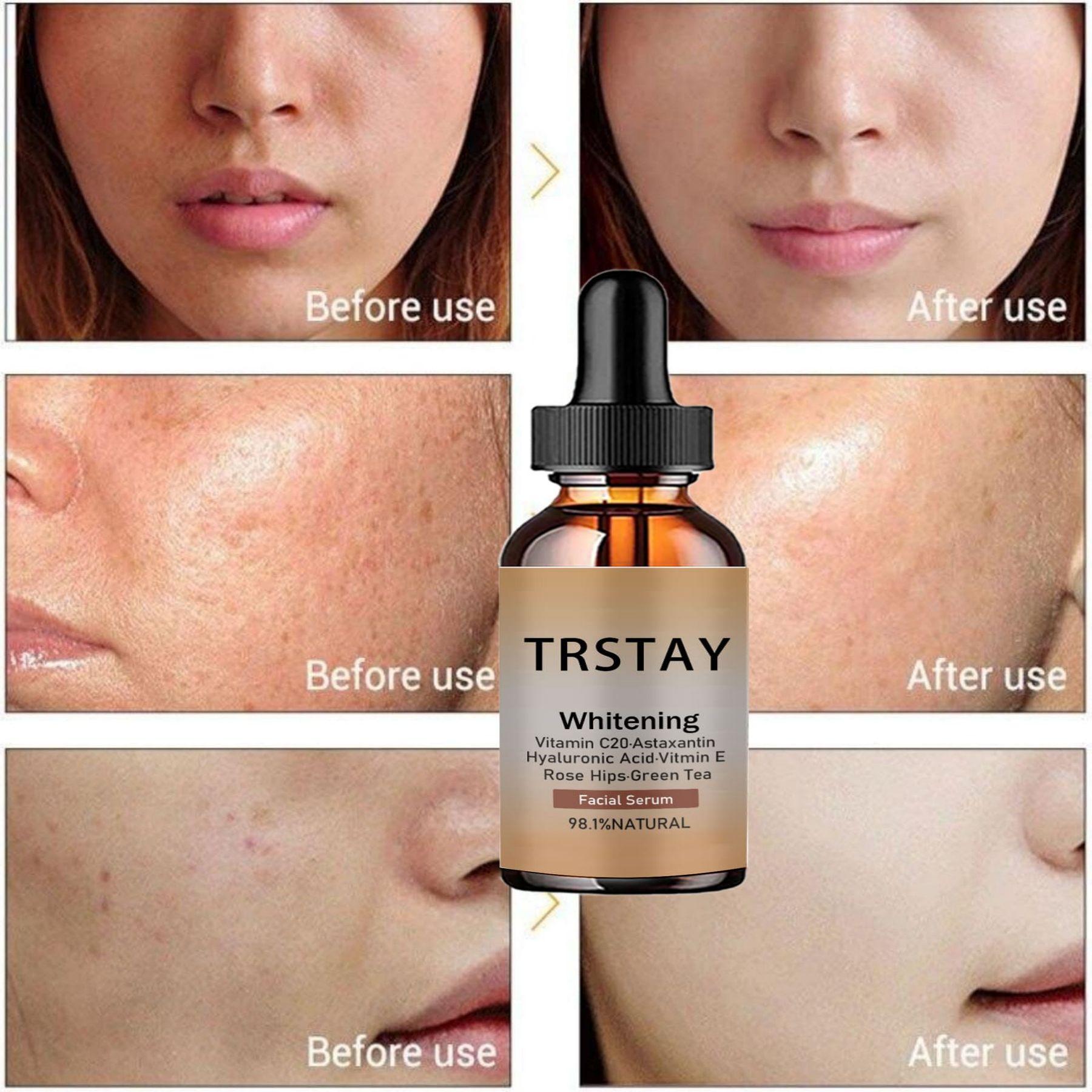 Face Essence essential Oils Anti Wrinkle Anti-aging Lighten Spots Brightening Facial Skin Fade Remove Freckle Speckle Care
Face Essence essential Oils Anti Wrinkle Anti-aging Lighten Spots Brightening Facial Skin Fade Remove Freckle Speckle Care