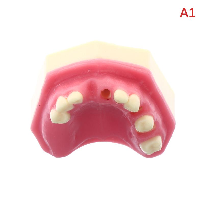 Teeth Loss Model Dental Implant Student Teaching Training Aid Practice Model Upper Jaw Lift Implants Restoration Model Lab as the picture
Teeth Loss Model Dental Implant Student Teaching Training Aid Practice Model Upper Jaw Lift Implants Restoration Model Lab as the picture