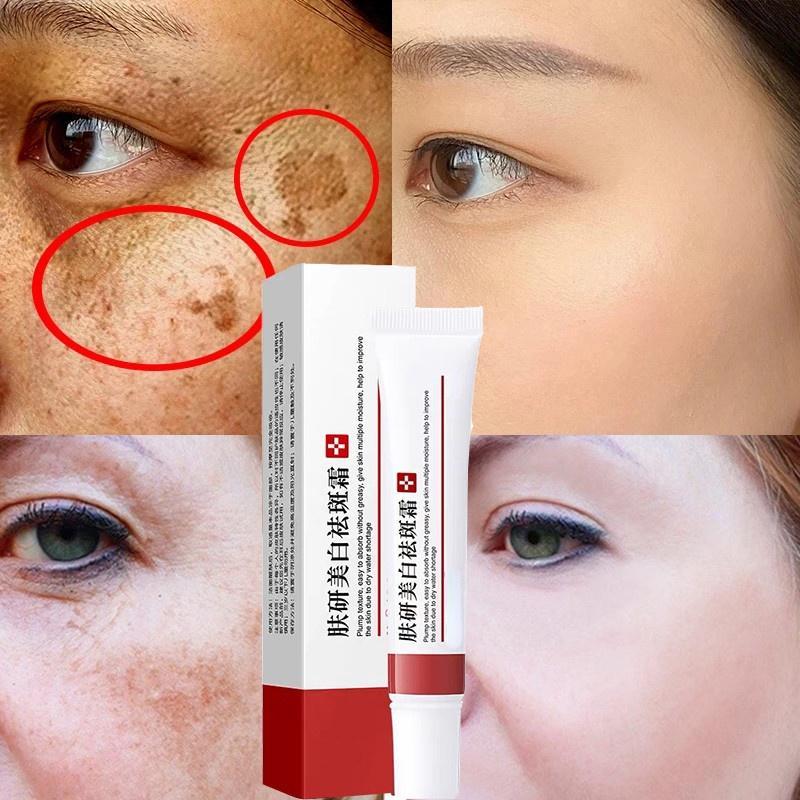 Эффективный крем от прыщей Pure Skin Anti-Aging Cream Антивозрастной крем против веснушек Увлажняющий крем от прыщей Удаление темных пятен Уход за кожей Отбеливающий крем
Эффективный крем от прыщей Pure Skin Anti-Aging Cream Антивозрастной крем против веснушек Увлажняющий крем от прыщей Удаление темных пятен Уход за кожей Отбеливающий крем