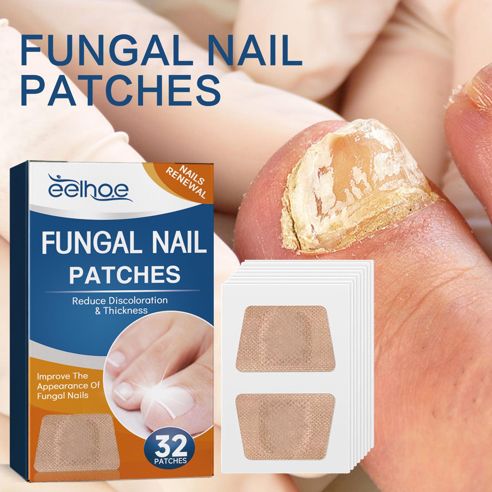 32PCS Foot Nail Repair Patch Grey Fungal Nail Thicken Soft Paronychia Infection Hand Nail Correction Sticker Ingrown Toenail 1 box
32PCS Foot Nail Repair Patch Grey Fungal Nail Thicken Soft Paronychia Infection Hand Nail Correction Sticker Ingrown Toenail 1 box
