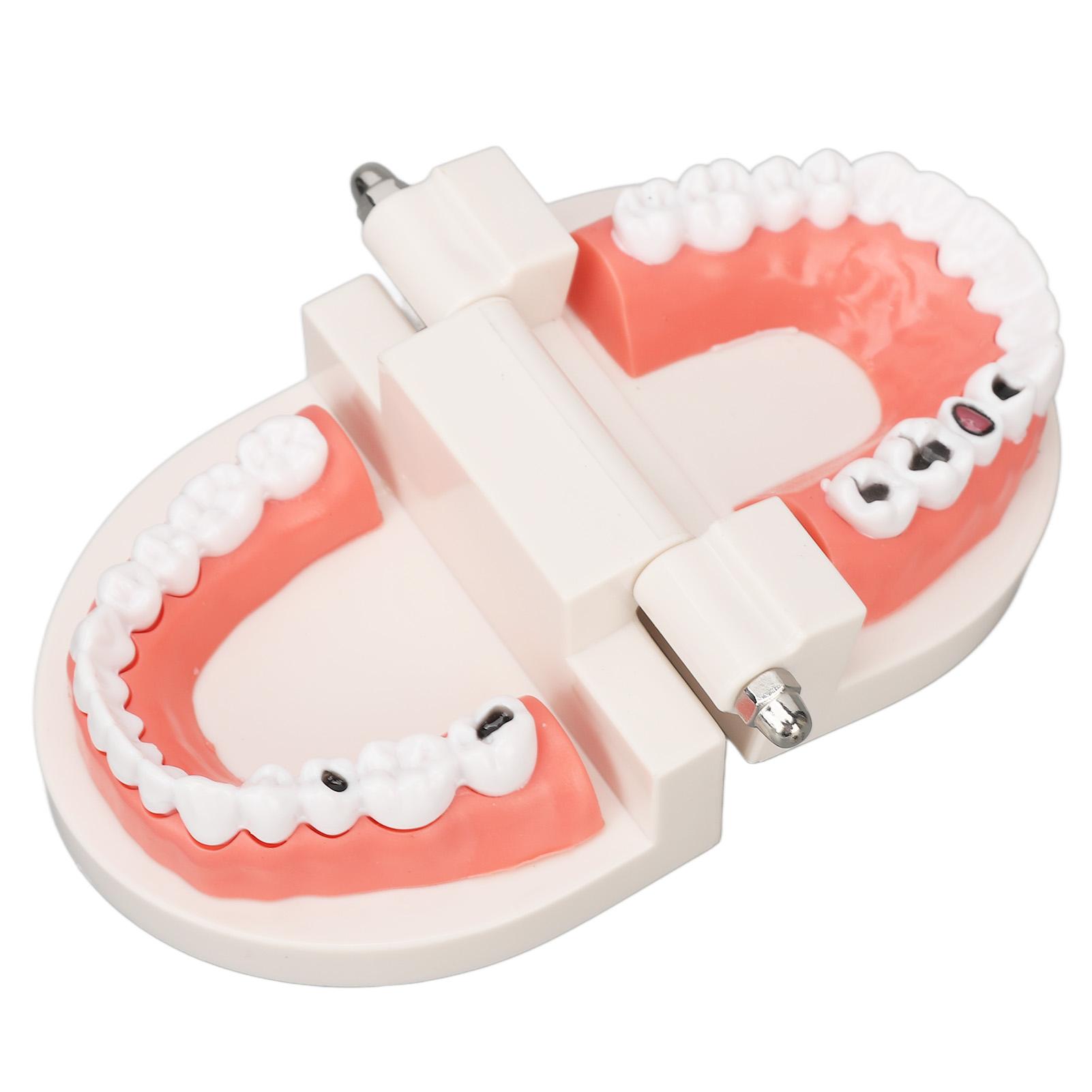 Dental Disease Caries Teeth Model Resin Simulation Teaching Prop Dental Teeth Model for Patient Student Education
Dental Disease Caries Teeth Model Resin Simulation Teaching Prop Dental Teeth Model for Patient Student Education