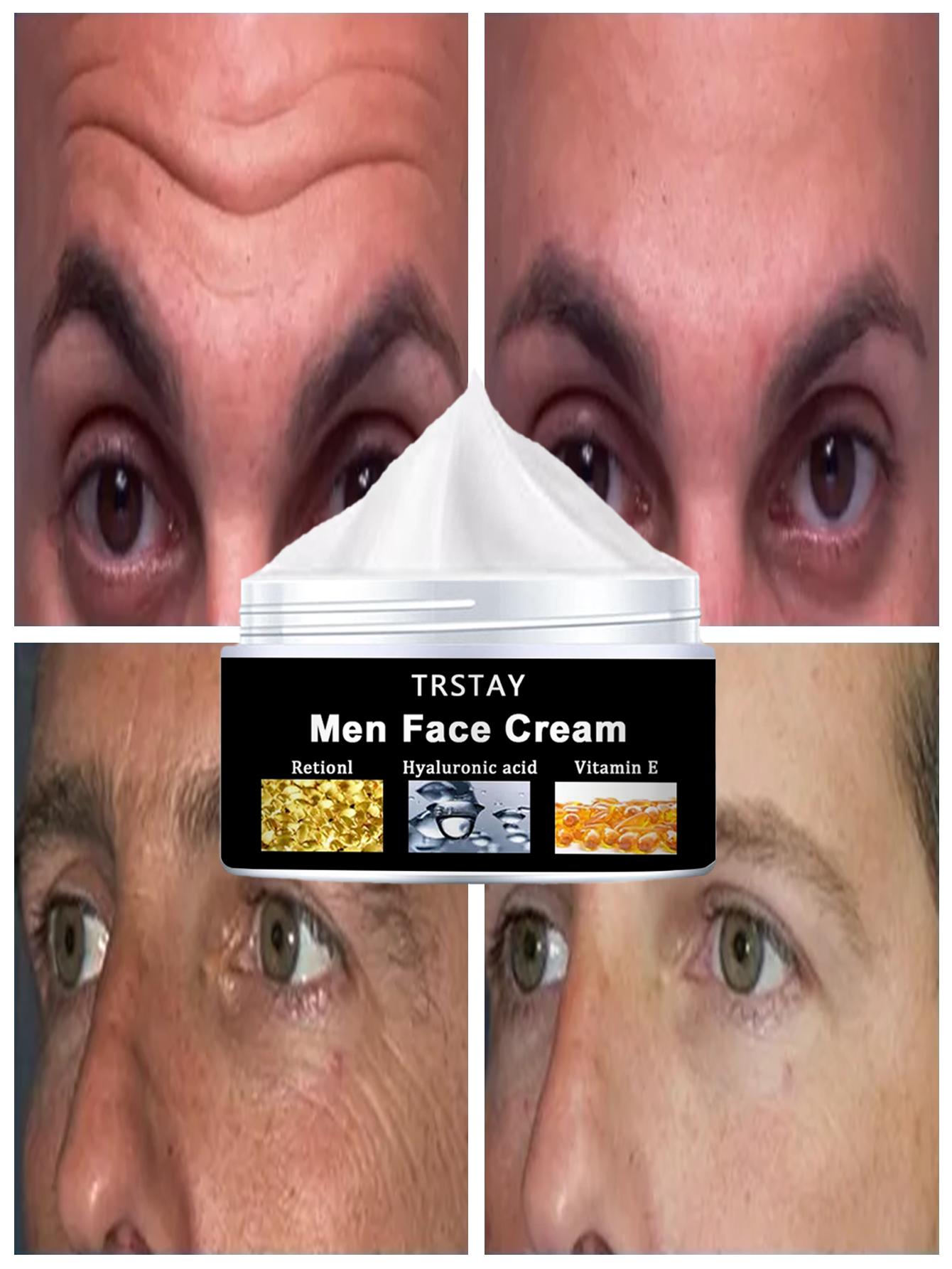 TRSTAY Nicotinamide Essence Can Remove Black Spots, Whiten And Brighten Pores, Shrink Hyaluronic Acid Collagen, And Protect The Face
TRSTAY Nicotinamide Essence Can Remove Black Spots, Whiten And Brighten Pores, Shrink Hyaluronic Acid Collagen, And Protect The Face