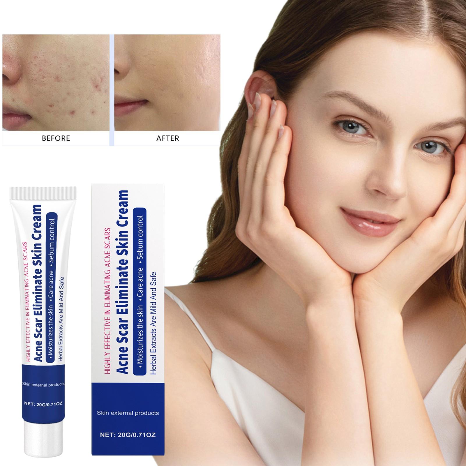 Крем от прыщей Dot Cream Acne Scar Skin Cream For Natural Gel For The Face 20g белый
Крем от прыщей Dot Cream Acne Scar Skin Cream For Natural Gel For The Face 20g белый