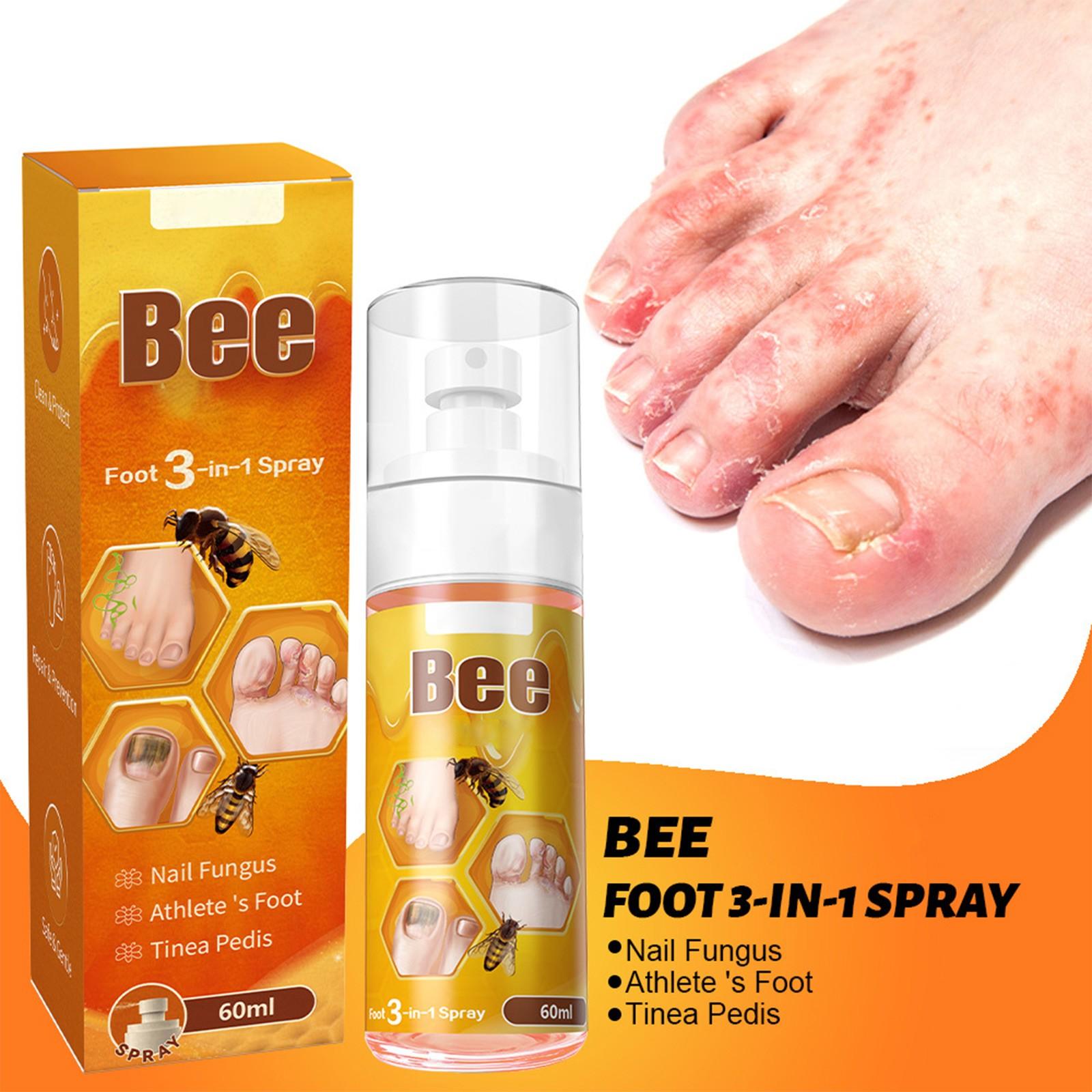 Спрей для нігтів Bee Олія для росту Олія для нігтів Догляд за мікозом Для мікозу нігтів Мікоз стопи Червоно-коричневий Колір стопи 60 мл жовтий
Спрей для нігтів Bee Олія для росту Олія для нігтів Догляд за мікозом Для мікозу нігтів Мікоз стопи Червоно-коричневий Колір стопи 60 мл жовтий