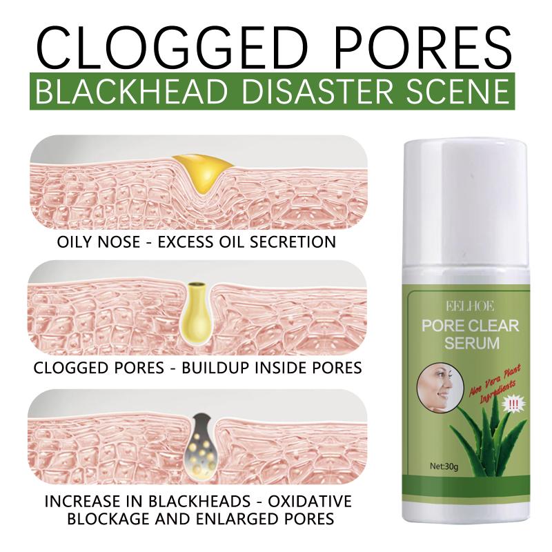 Blackhead Remover Deep Cleansing Acne Pore Dirts Oil Control Moisturizing Improving Rough Brightening Nose Treatment Cream one size
Blackhead Remover Deep Cleansing Acne Pore Dirts Oil Control Moisturizing Improving Rough Brightening Nose Treatment Cream one size