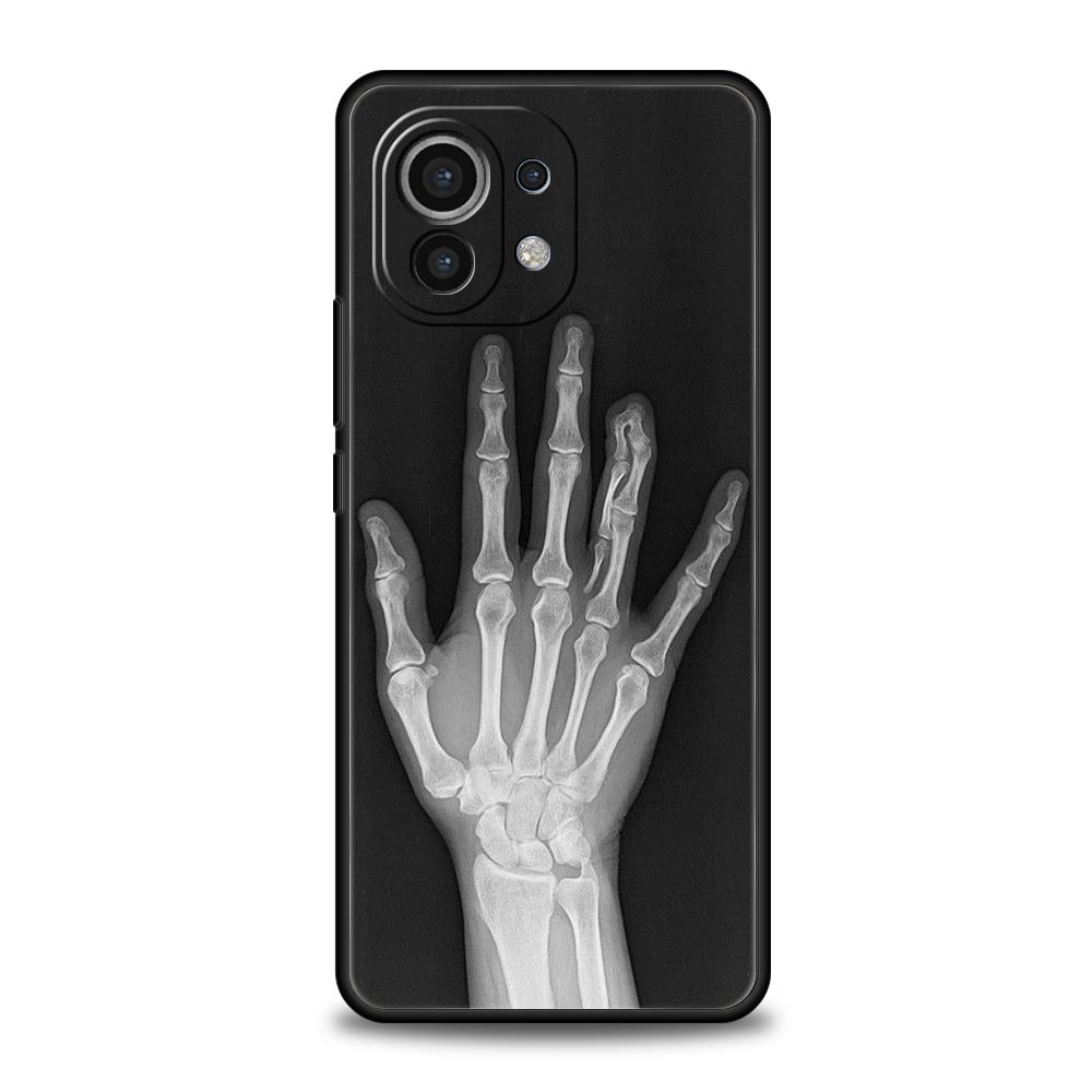 Чехол для телефона для Xiaomi Mi 15/14/13/12/11/Ultra/14T/13T/12T/11T/10T/Pro/Lite/5G Мягкий ТПУ Корпус Осенний Рентген Кости Руки Чехлы Xiaomi 12 Pro
Чехол для телефона для Xiaomi Mi 15/14/13/12/11/Ultra/14T/13T/12T/11T/10T/Pro/Lite/5G Мягкий ТПУ Корпус Осенний Рентген Кости Руки Чехлы Xiaomi 12 Pro