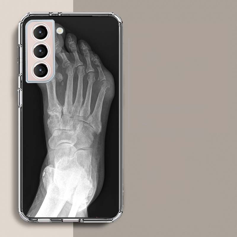 Autumu X ray Hand Bones Phone Case For Samsung Galaxy S25 Edge S24 S23 FE S21 S20 Plus S22 S26 Ultra Cover Clear Cases TPU Capa Samsung S25 Plus
Autumu X ray Hand Bones Phone Case For Samsung Galaxy S25 Edge S24 S23 FE S21 S20 Plus S22 S26 Ultra Cover Clear Cases TPU Capa Samsung S25 Plus